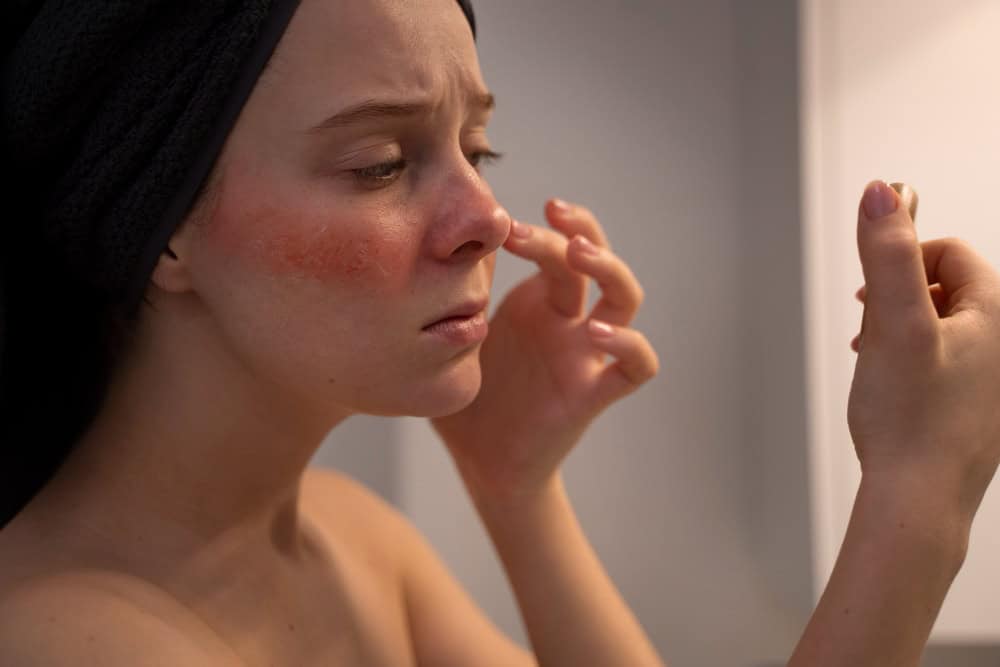Step-by-step skincare routine with adapalene and benzoyl peroxide