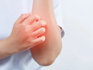 Top 5 Itch Relief Creams for Intimate Areas