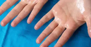 Understanding Prescription Deodorants: A Comprehensive Guide