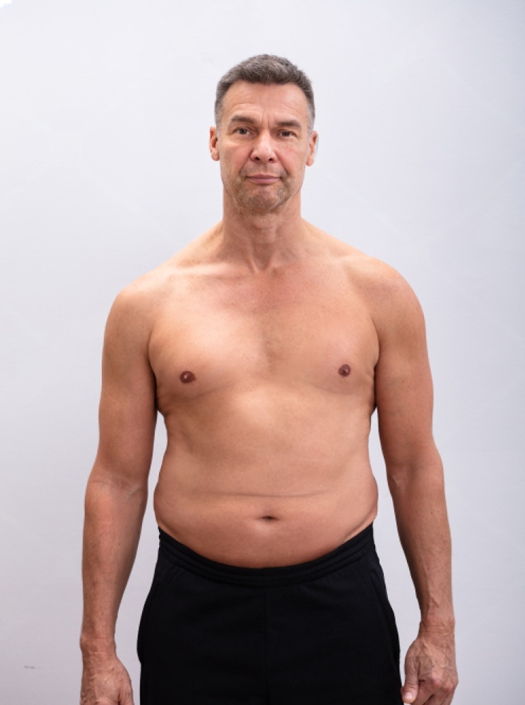 wmremove transformed 3 1